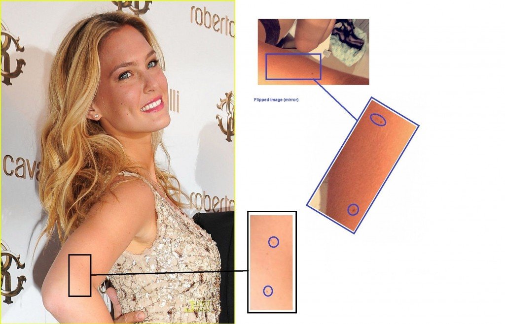 Bar-Refaeli-Photo-Proofs-Le lentiggini sul braccio